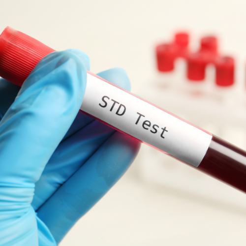 STI & Viral Marker Basic